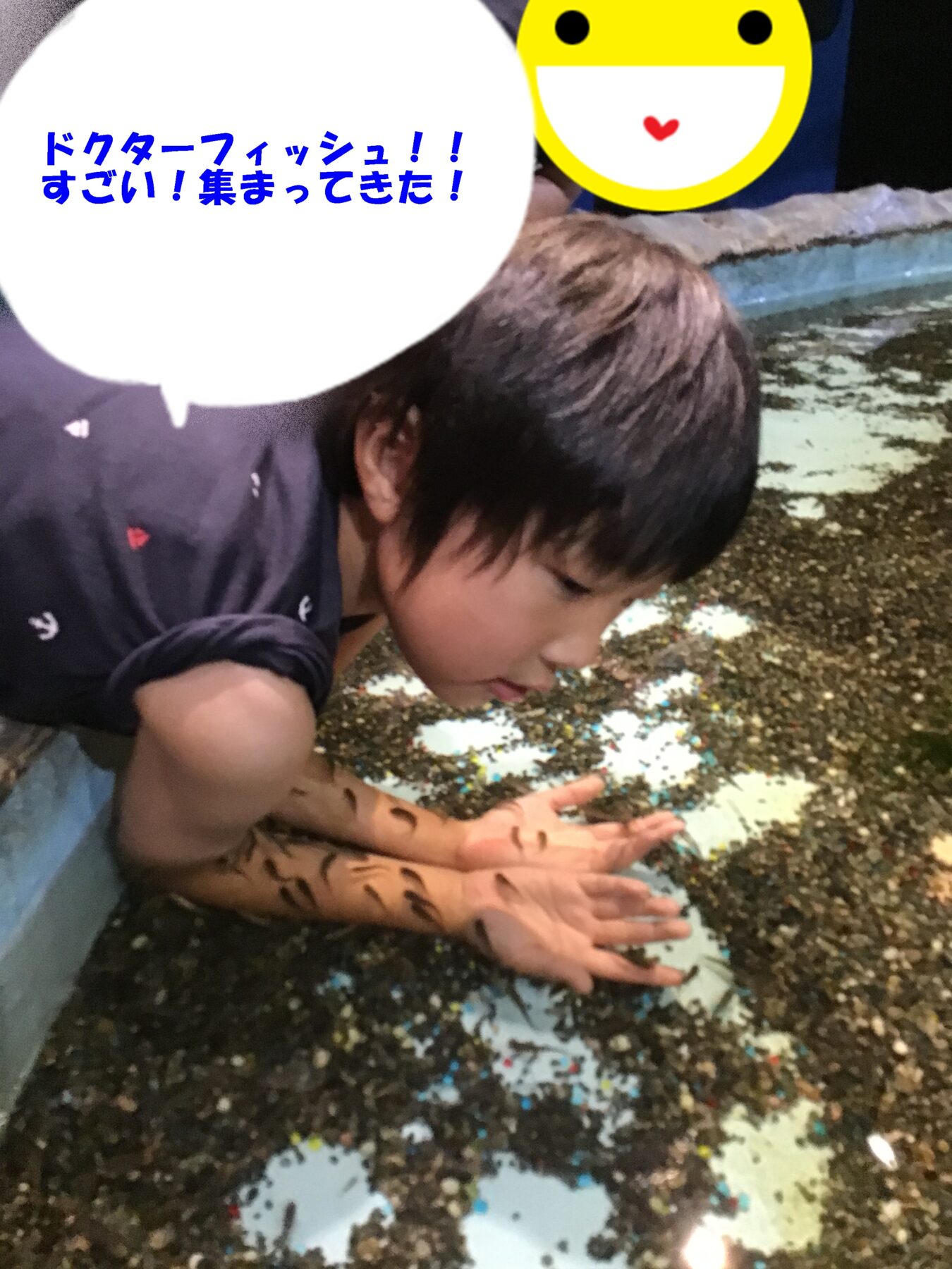 Child crouches by a Doctor Fish spa tank, hands in the water with colorful gravel; a speech bubble in Japanese reads: 'Doctor Fish!! Amazing! They’ve gathered!'